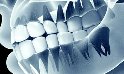 occlusodontie-2 Occlusodontie Dr Perriat